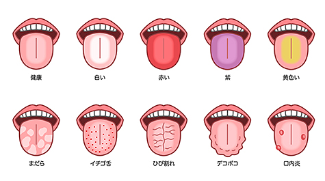 さまざまな症状の舌